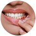 Gum Treatment in BTM Layout 1st Stage