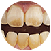 Stained Teeth Treatment BTM Layout
